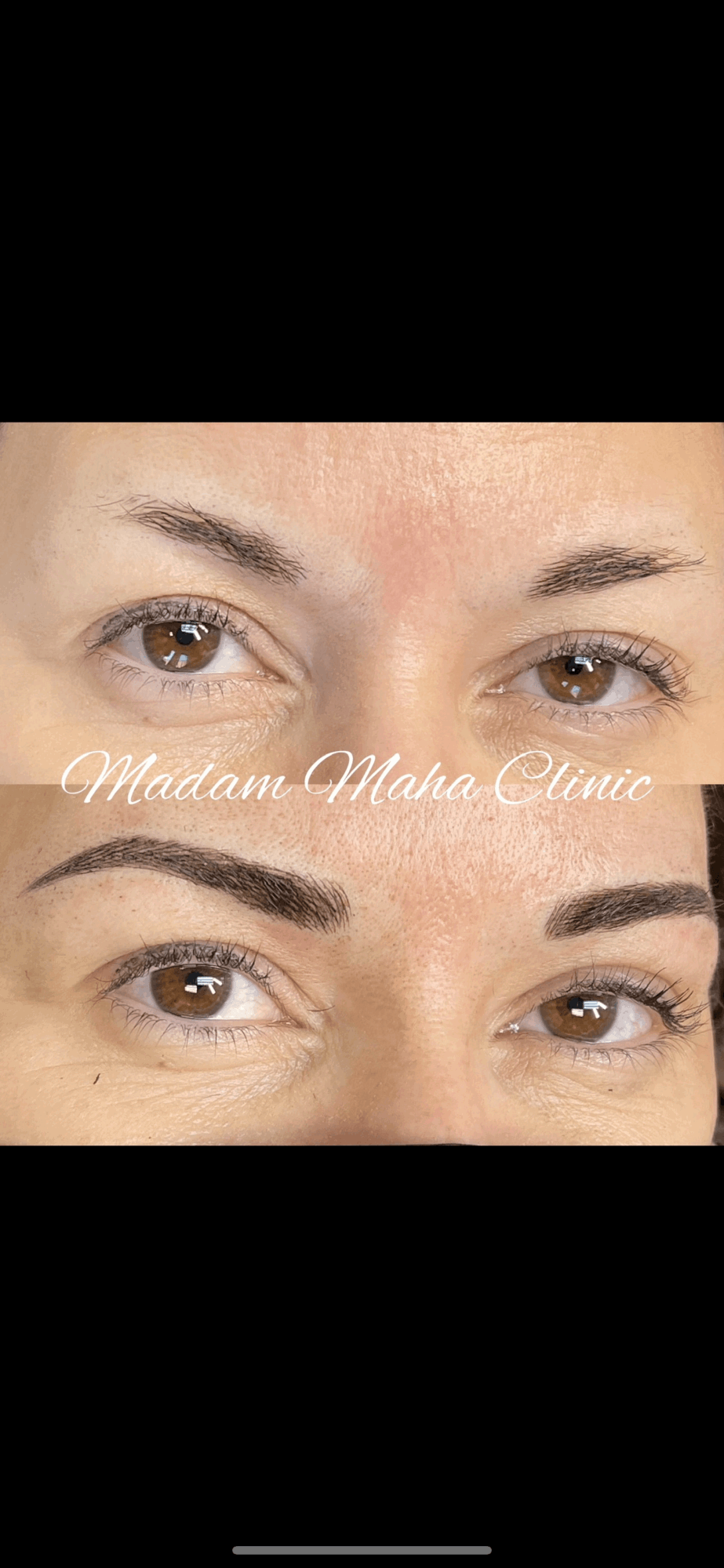 Close-up of a person's eyes before and after eyelash extension application, showing improved fullness and length.