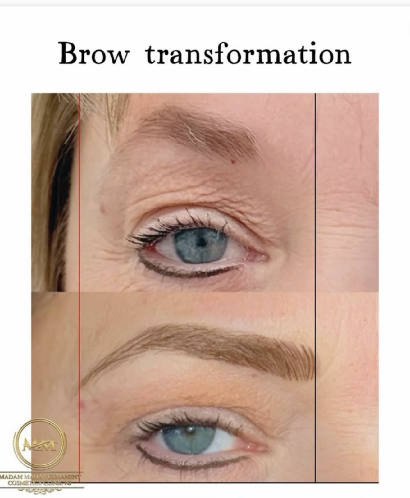 Comparison of a person's eye before and after eyebrow transformation, showing improved eyebrow shape and fullness.